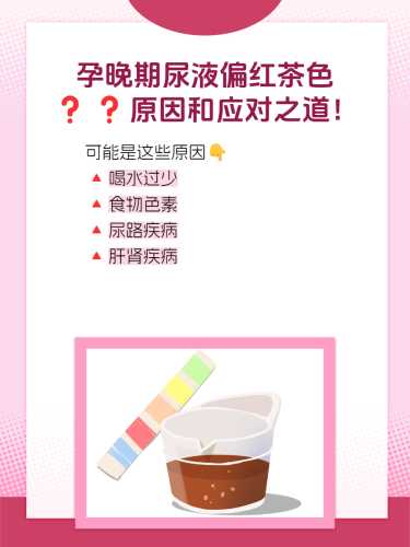 产后尿液呈茶色是怎么回事-第1张图片