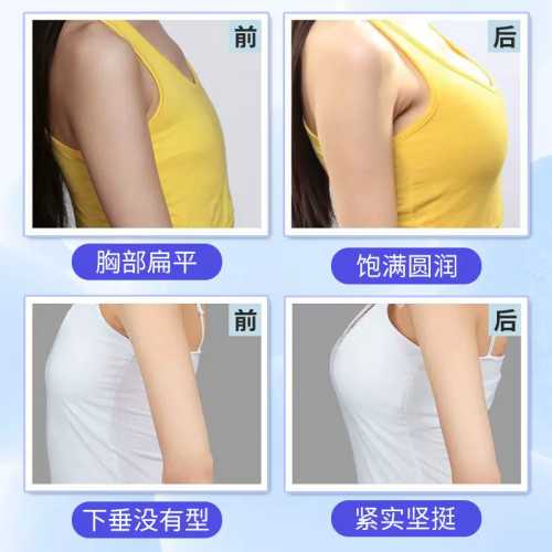 产后乳房下垂怎么有效丰胸-第1张图片