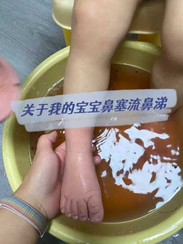 婴儿鼻屎多怎么办-第1张图片