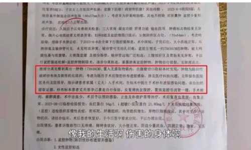剖腹产多久去医院复查-第1张图片