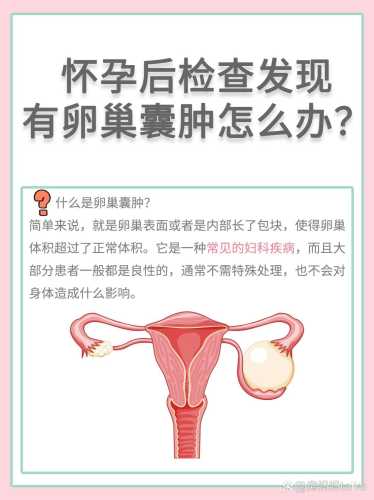 怀孕了能切除囊肿吗-第1张图片