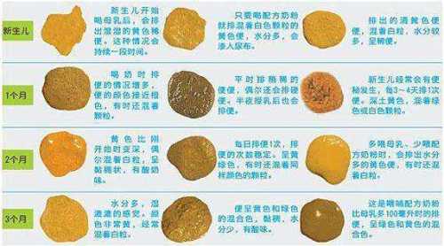 婴儿正常大便如何判断-第1张图片