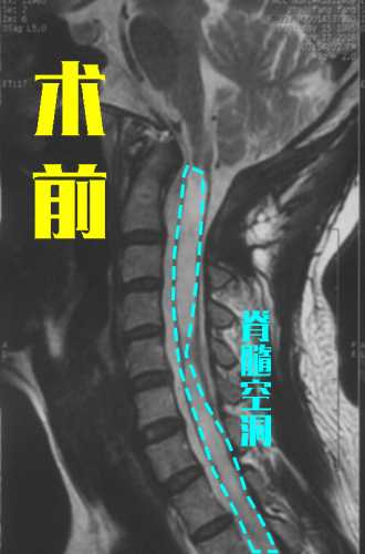 宣武医院能剖腹产吗-第1张图片