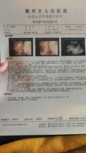 备孕二胎男性会有啥后果-第1张图片