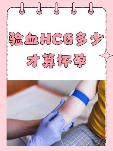 备孕抽血是什么意思啊-第1张图片