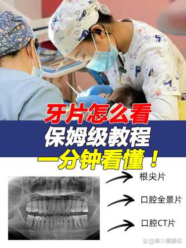 备孕前是否需拔智齿补牙-第1张图片