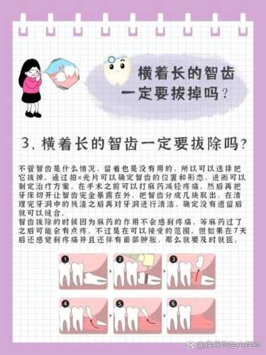 备孕时智齿一定要拔吗-第1张图片