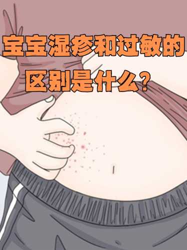 新生儿为何易长湿疹-第1张图片