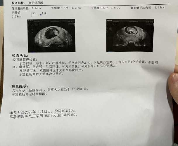 孕19周开始孕反正常吗-第1张图片