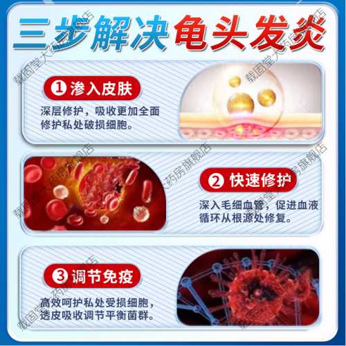 甲硝锉影响男方备孕吗-第1张图片