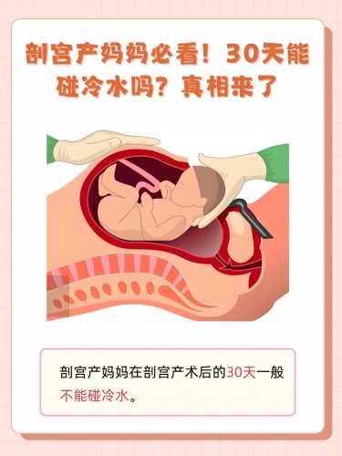 顺产后多久可以下床活动-第1张图片