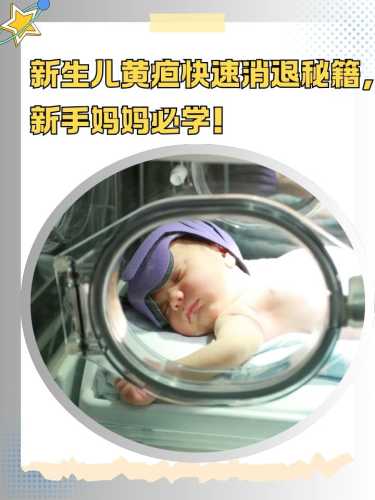 新生儿黄疸20严重吗-第1张图片