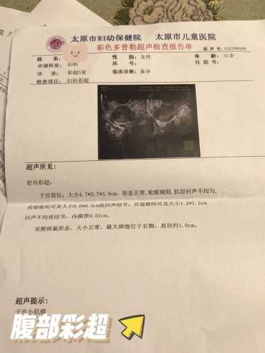 备孕能不能检查内检-第1张图片