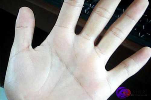 婴儿通贯手意味着什么-第1张图片