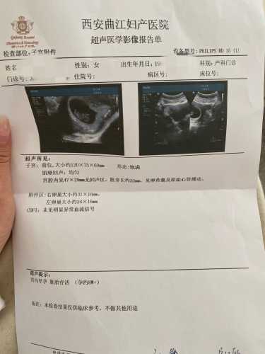 孕15周为何晚上孕反厉害-第1张图片