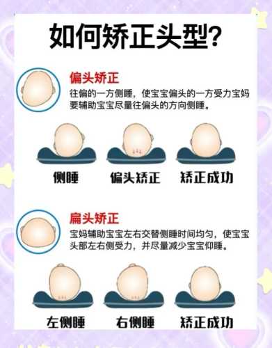 婴儿扁头怎么办能矫正吗-第1张图片