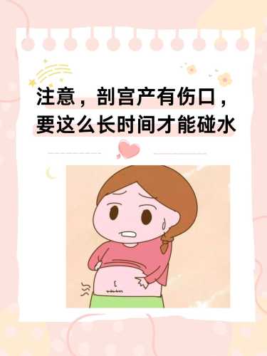 剖宫产后护理要注意什么-第1张图片