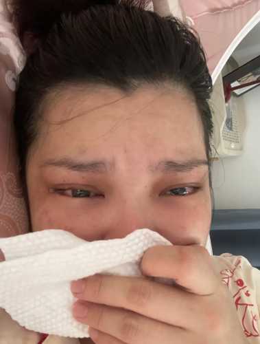 剖腹产后晕车是怎么回事-第1张图片