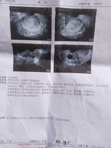备孕雌二醇125正常吗-第1张图片