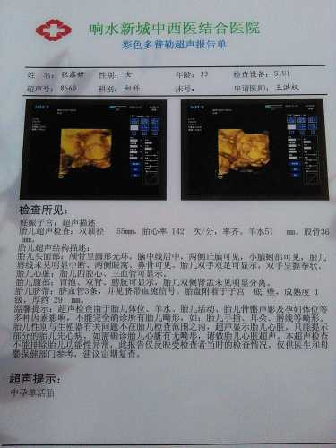 孕九周孕反浑身发冷咋回事-第1张图片