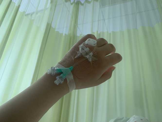 剖腹产免拆针要注意什么-第1张图片