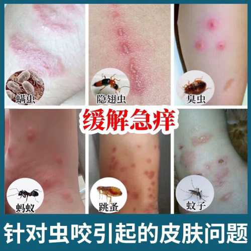 婴儿丘疹怎么办-第1张图片