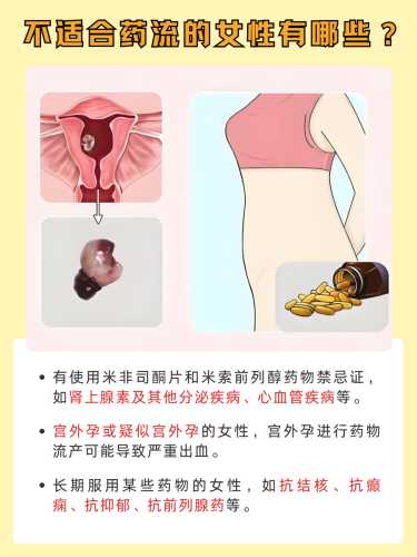 药物流产后肚子疼多久-第1张图片