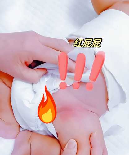 晚上戒尿不湿怎么训练-第1张图片