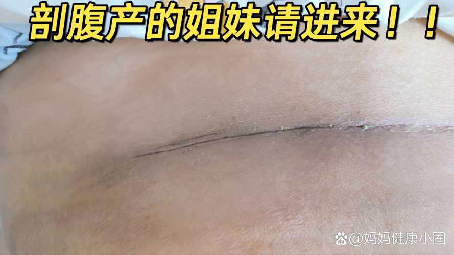 产后多久可以洗澡洗头-第1张图片
