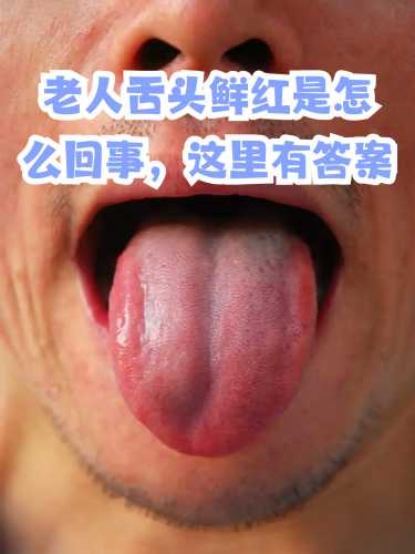 产后舌头涩是何原因所致-第1张图片