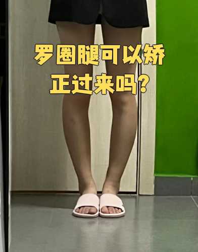 穿拉拉裤会导致罗圈腿吗-第1张图片