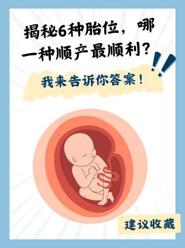怎样才能顺利顺产-第1张图片
