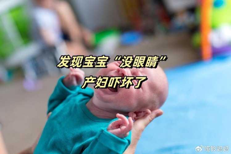 新生儿眼睛为啥睁不大-第1张图片