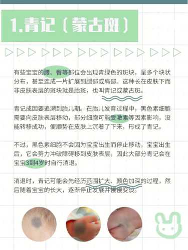 备孕吃红枣会长胎记吗-第1张图片