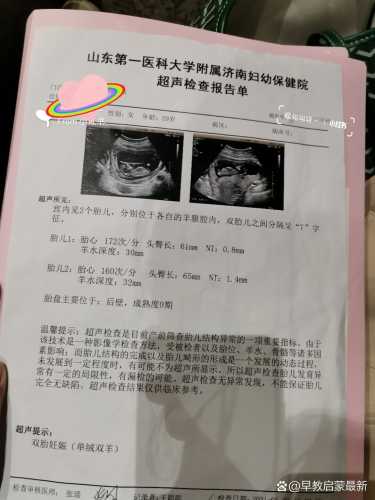 彩超做多影响备孕吗-第1张图片