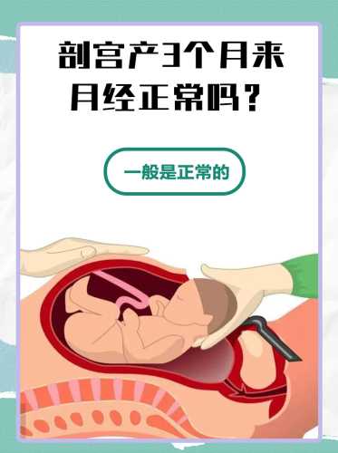 产后两个月会来月经吗-第1张图片