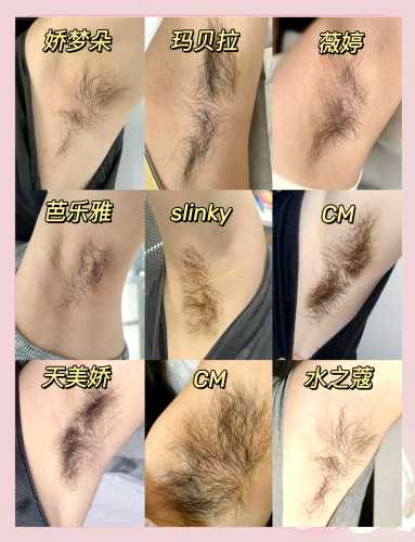 手臂脱毛影响备孕吗-第1张图片