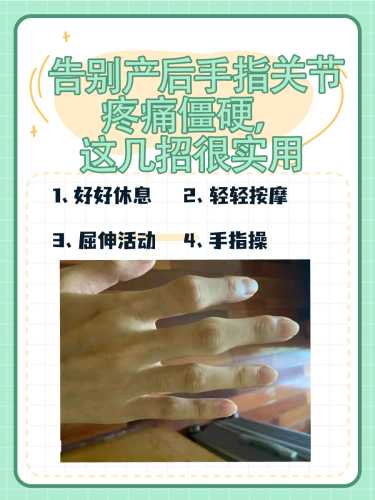 产后手指缝痒怎么办-第1张图片