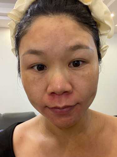 坐月子期间能护肤擦脸吗-第1张图片