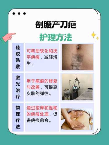 剖腹产伤口黏黏的是怎么回事-第1张图片