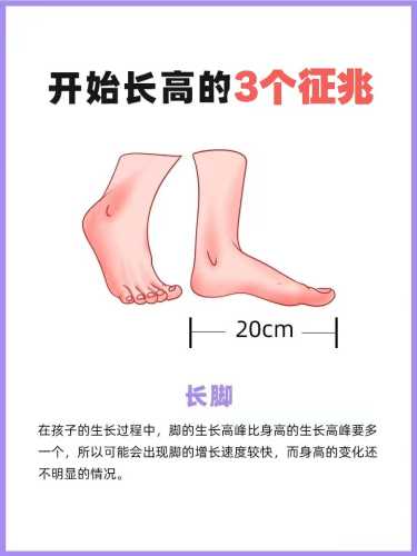 婴儿猛长期该注意什么-第1张图片