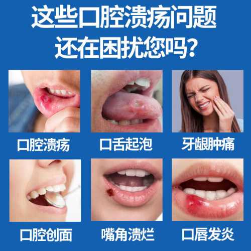 新生儿嘴巴起泡是怎么回事-第1张图片