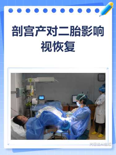 二胎剖腹产有视频吗-第1张图片