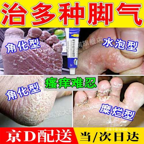 怀孕脚痒能涂药膏吗-第1张图片