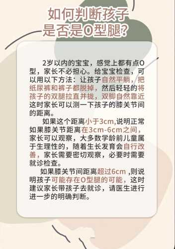 尿不湿会导致宝宝O型腿吗-第1张图片