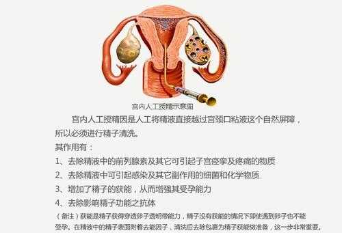 做试管婴儿的地方在哪里-第1张图片