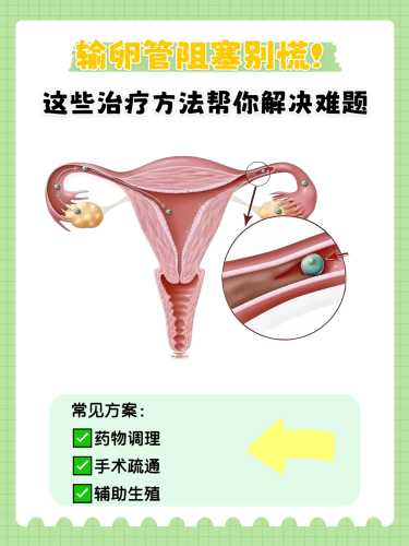 备孕紧张怀不上怎么办-第1张图片