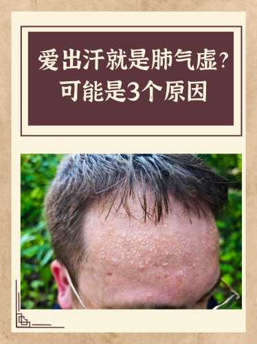 婴儿盗汗是什么原因引起的-第1张图片