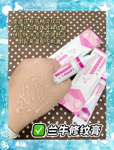 产后妊娠纹会自然消失吗-第1张图片