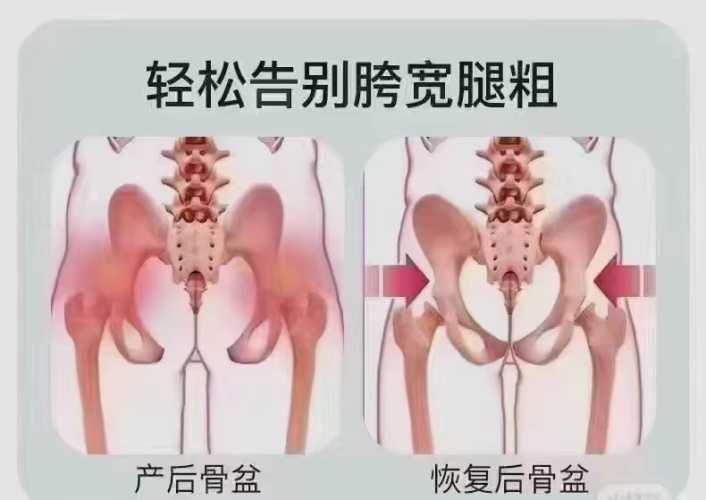 产后做骨盆修复会疼吗-第1张图片